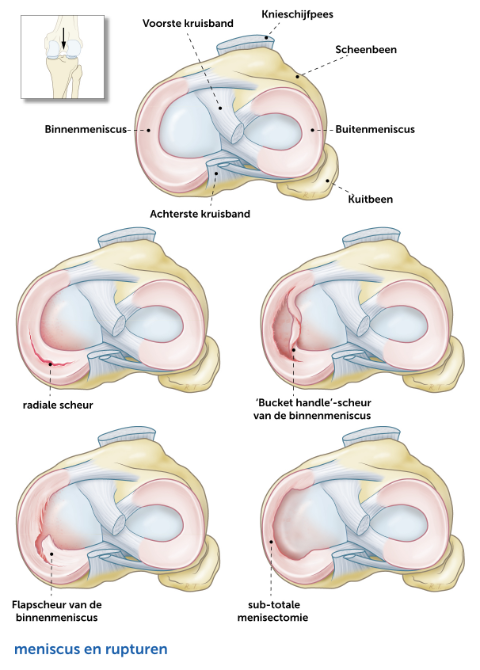 Meniscus