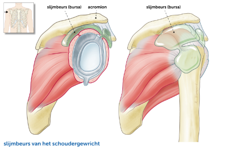 subacromiaal-pijnsyndroom-bursa
